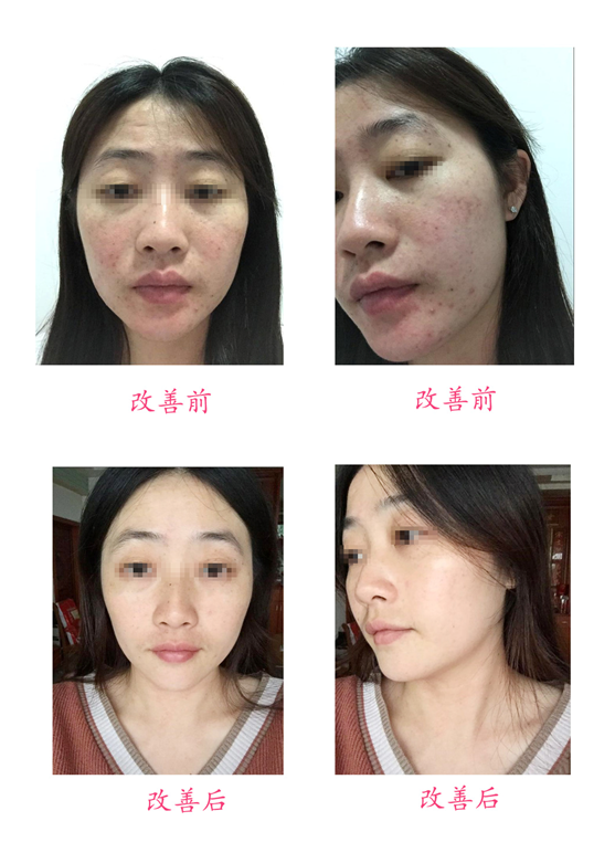 改善前后對比