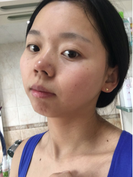 現在的我肌膚越來越好