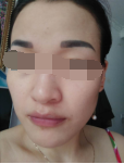 斑點(diǎn)敏感暗黃