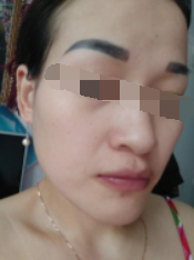 二次復(fù)診